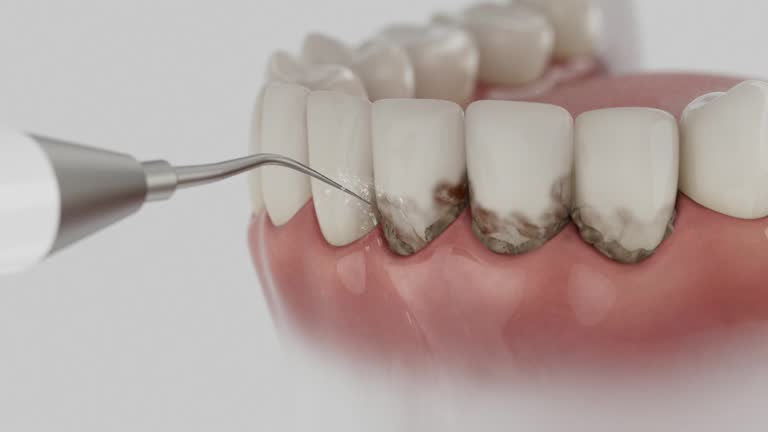 Trusted Root Canal Treatment service in Hayfield, VA - Dentist Open Now